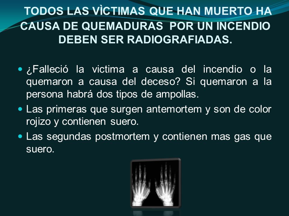 TODOS LAS VÌCTIMAS QUE HAN MUERTO HA CAUSA DE QUEMADURAS POR UN INCENDIO DEBEN SER RADIOGRAFIADAS.