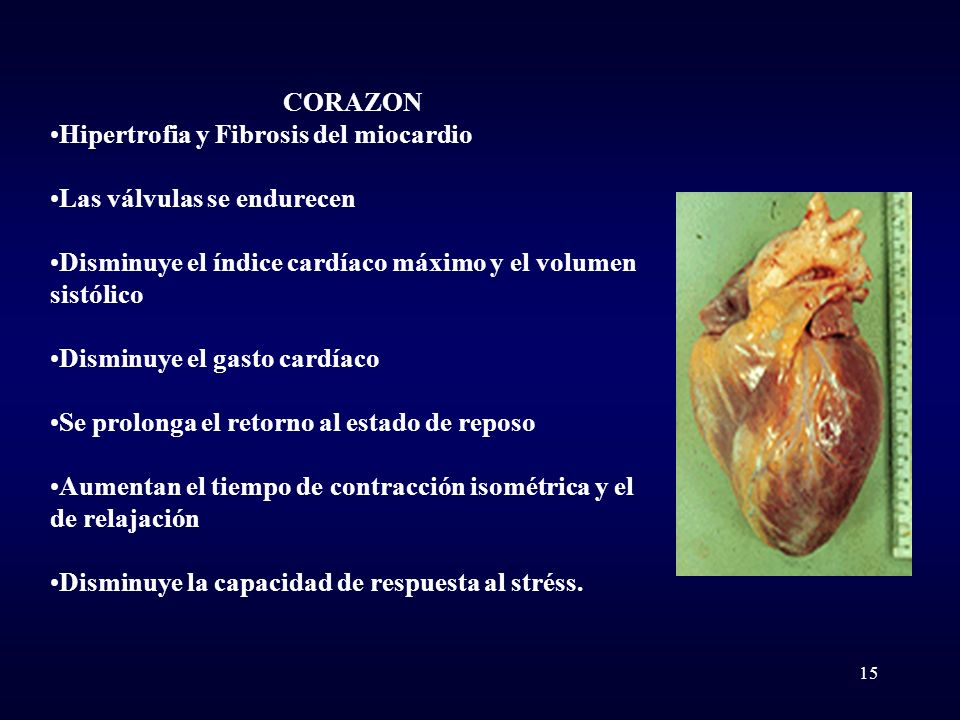CORAZON Hipertrofia y Fibrosis del miocardio. Las válvulas se endurecen. Disminuye el índice cardíaco máximo y el volumen sistólico.