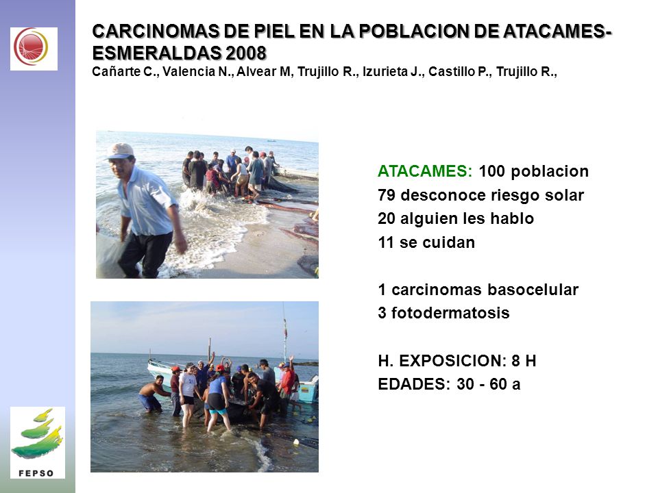 CARCINOMAS DE PIEL EN LA POBLACION DE ATACAMES-ESMERALDAS 2008 Cañarte C., Valencia N., Alvear M, Trujillo R., Izurieta J., Castillo P., Trujillo R.,