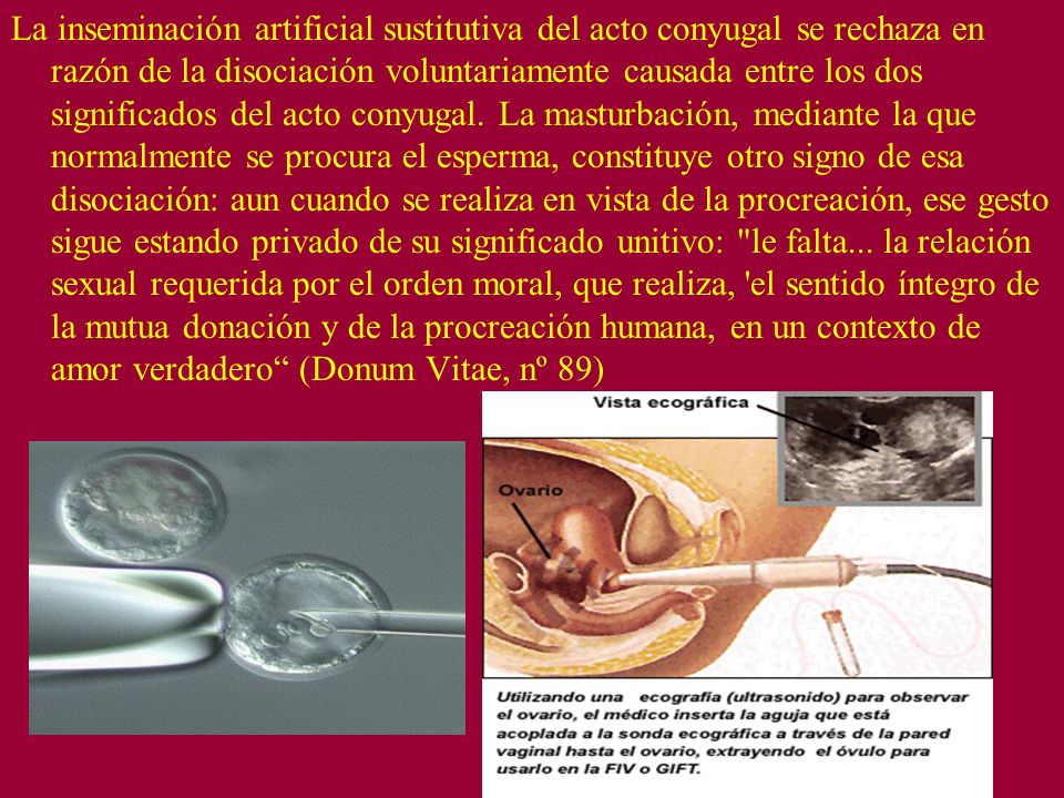 La inseminación artificial sustitutiva del acto conyugal se rechaza en razón de la disociación voluntariamente causada entre los dos significados del acto conyugal.