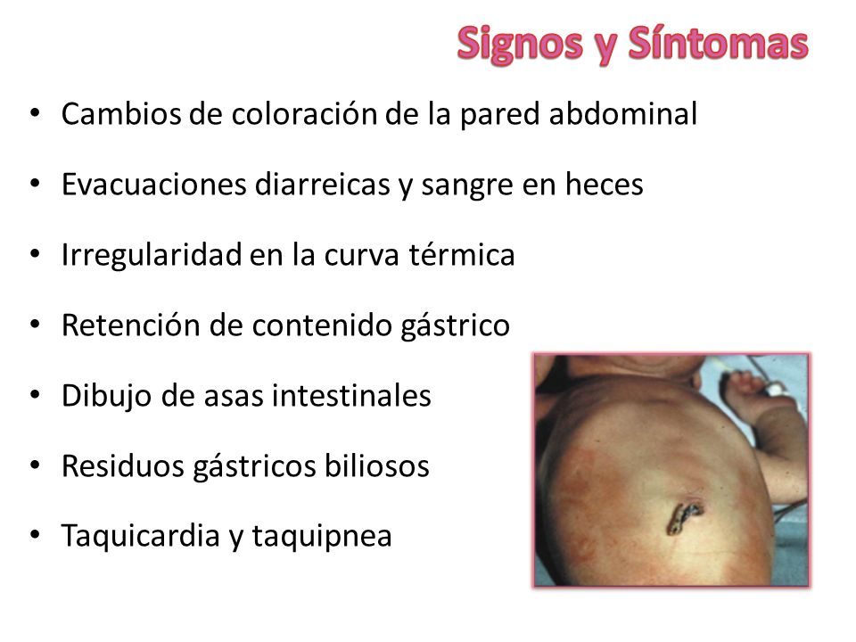 Signos y Síntomas Cambios de coloración de la pared abdominal