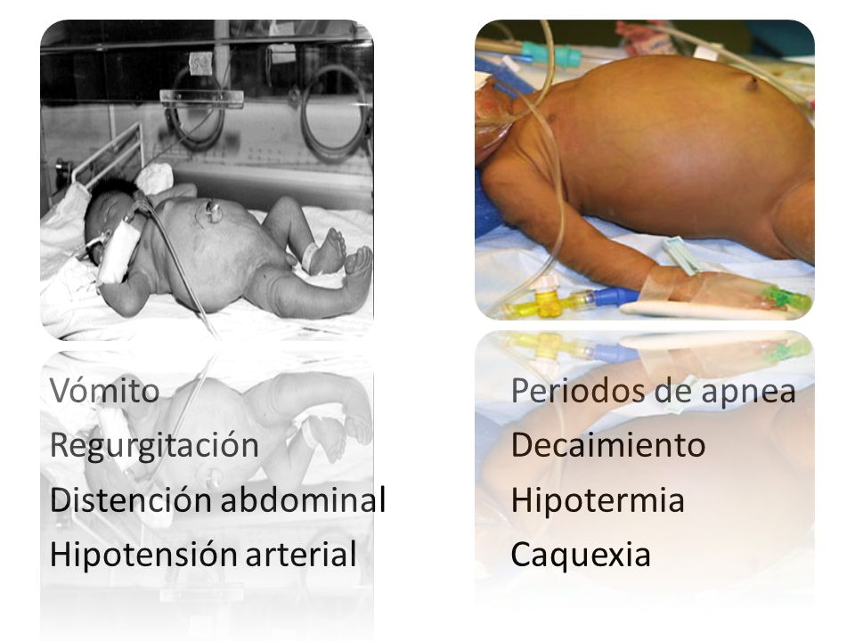 Vómito Periodos de apnea. Regurgitación. Decaimiento. Distención abdominal. Hipotermia. Hipotensión arterial.