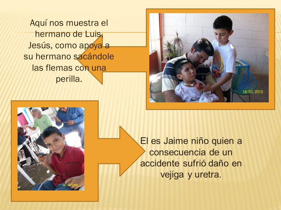 Aquí nos muestra el hermano de Luis, Jesús, como apoya a su hermano sacándole las flemas con una perilla.