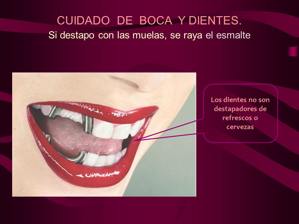 Los dientes no son destapadores de refrescos o cervezas