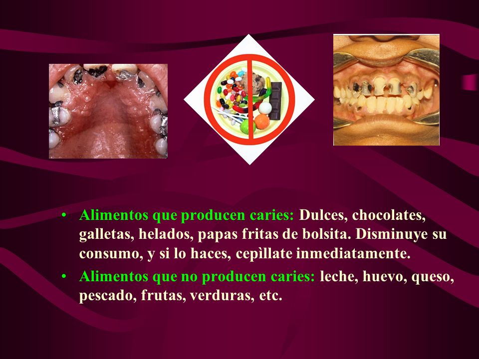 Alimentos que producen caries: Dulces, chocolates, galletas, helados, papas fritas de bolsita. Disminuye su consumo, y si lo haces, cepìllate inmediatamente.