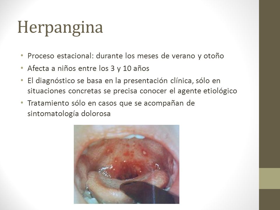 Herpangina Proceso estacional: durante los meses de verano y otoño