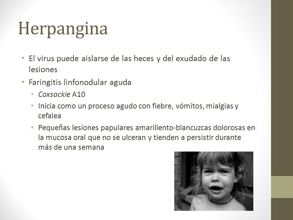 Herpangina El virus puede aislarse de las heces y del exudado de las lesiones. Faringitis linfonodular aguda.