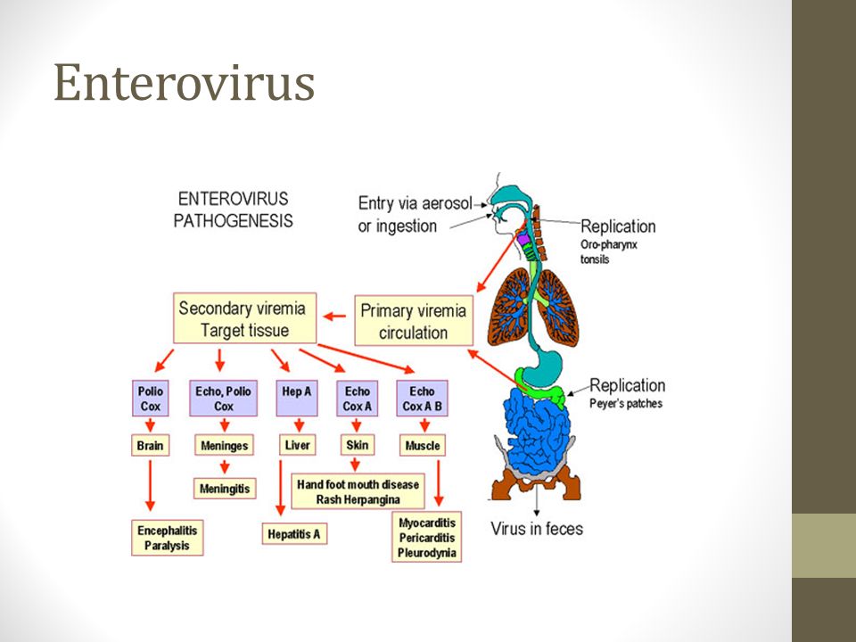 Enterovirus