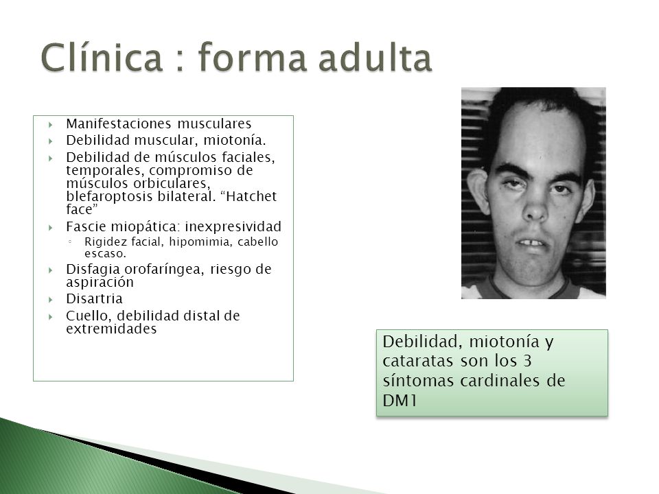 Clínica : forma adulta Manifestaciones musculares. Debilidad muscular, miotonía.