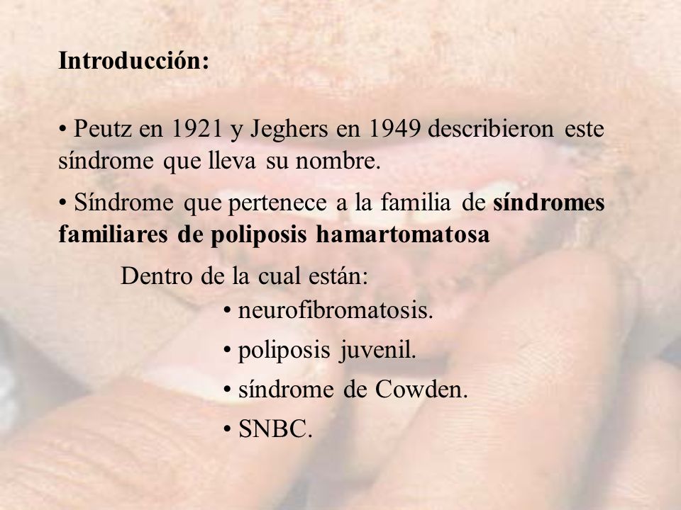 Introducción: Peutz en 1921 y Jeghers en 1949 describieron este síndrome que lleva su nombre.