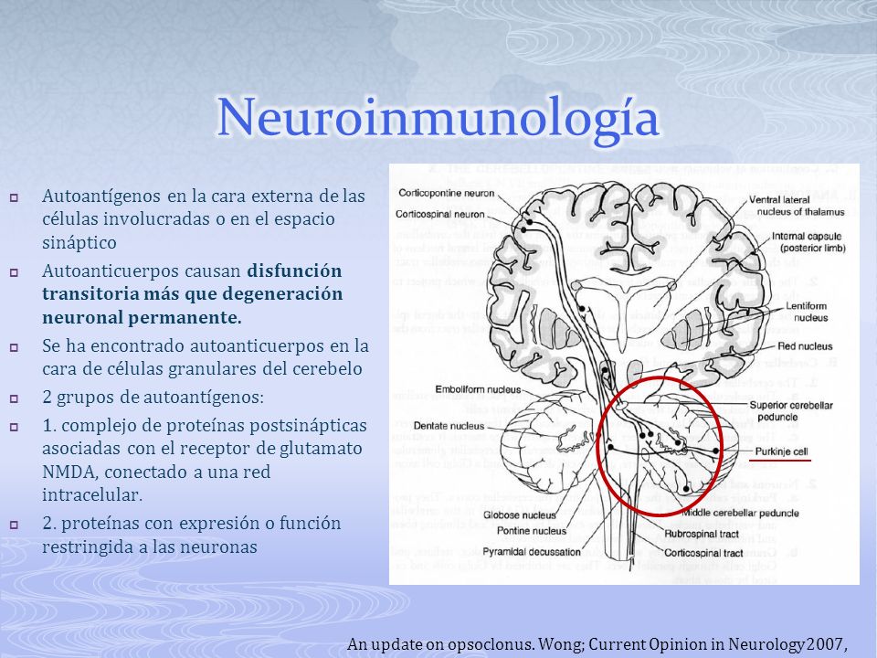 Neuroinmunología Autoantígenos en la cara externa de las células involucradas o en el espacio sináptico.