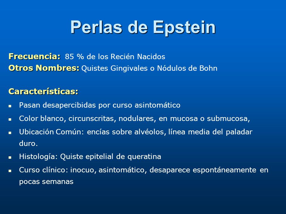 Perlas de Epstein Frecuencia: 85 % de los Recién Nacidos