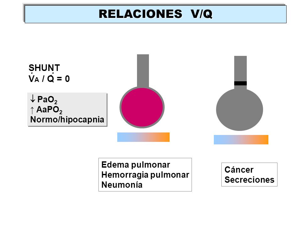 RELACIONES V/Q SHUNT VA / Q = 0  PaO2 ↑ AaPO2 Normo/hipocapnia