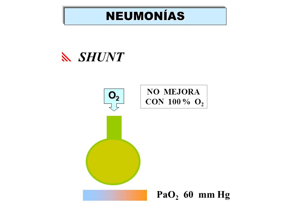 NEUMONÍAS SHUNT NO MEJORA CON 100 % O2 O2 PaO2 60 mm Hg