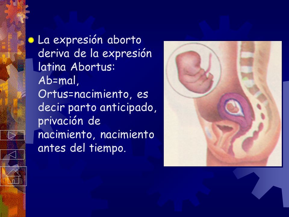 La expresión aborto deriva de la expresión latina Abortus: Ab=mal, Ortus=nacimiento, es decir parto anticipado, privación de nacimiento, nacimiento antes del tiempo.
