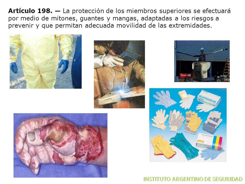 Artículo 198. — La protección de los miembros superiores se efectuará por medio de mitones, guantes y mangas, adaptadas a los riesgos a prevenir y que permitan adecuada movilidad de las extremidades.