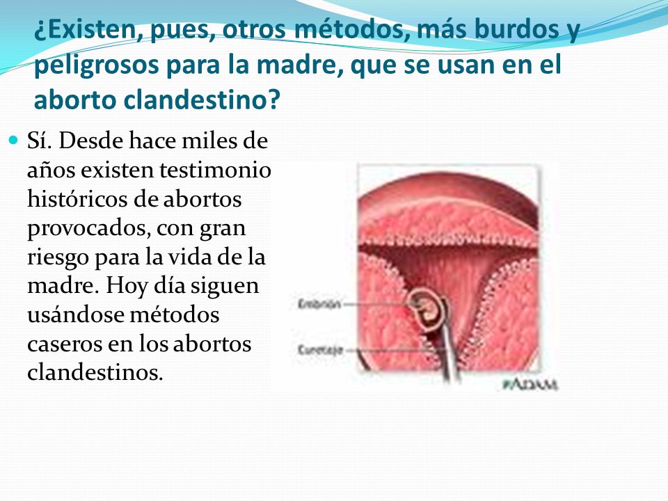 ¿Existen, pues, otros métodos, más burdos y peligrosos para la madre, que se usan en el aborto clandestino