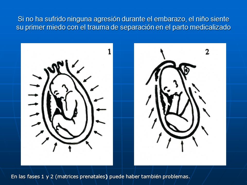Si no ha sufrido ninguna agresión durante el embarazo, el niño siente su primer miedo con el trauma de separación en el parto medicalizado