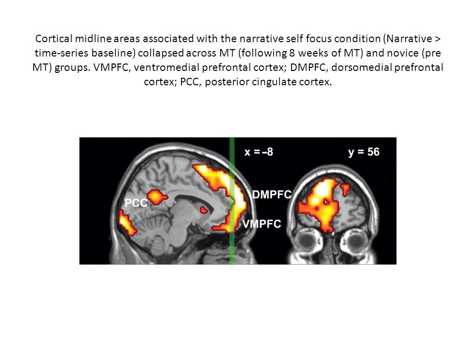 Cortical midline areas associated with the narrative self focus condition (Narrative > time-series baseline) collapsed across MT (following 8 weeks of MT) and novice (pre MT) groups.