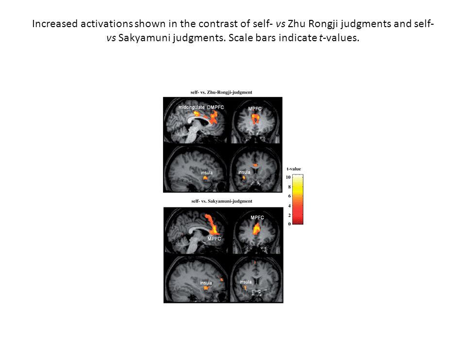 Increased activations shown in the contrast of self- vs Zhu Rongji judgments and self- vs Sakyamuni judgments.