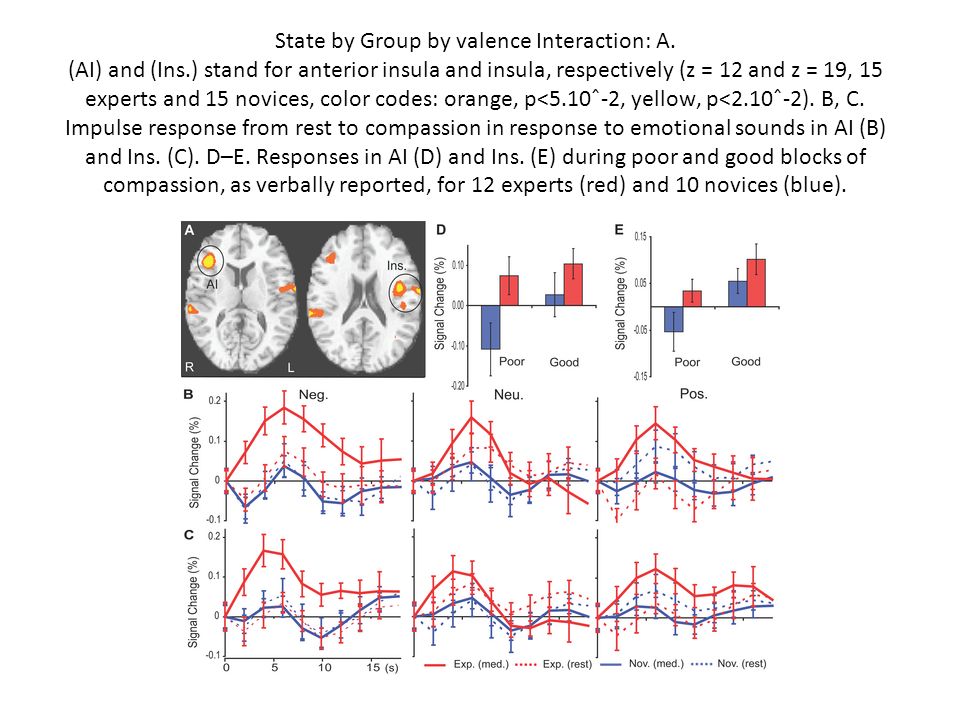 State by Group by valence Interaction: A. (AI) and (Ins