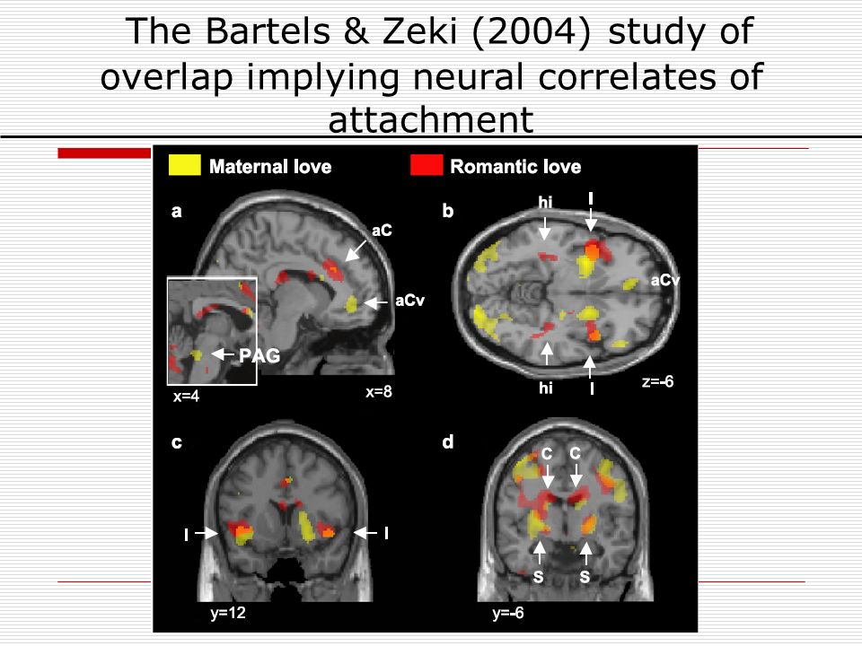 The Bartels & Zeki (2004) study of overlap implying neural correlates of attachment