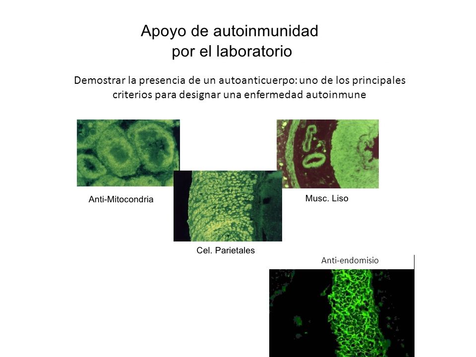 Demostrar la presencia de un autoanticuerpo: uno de los principales