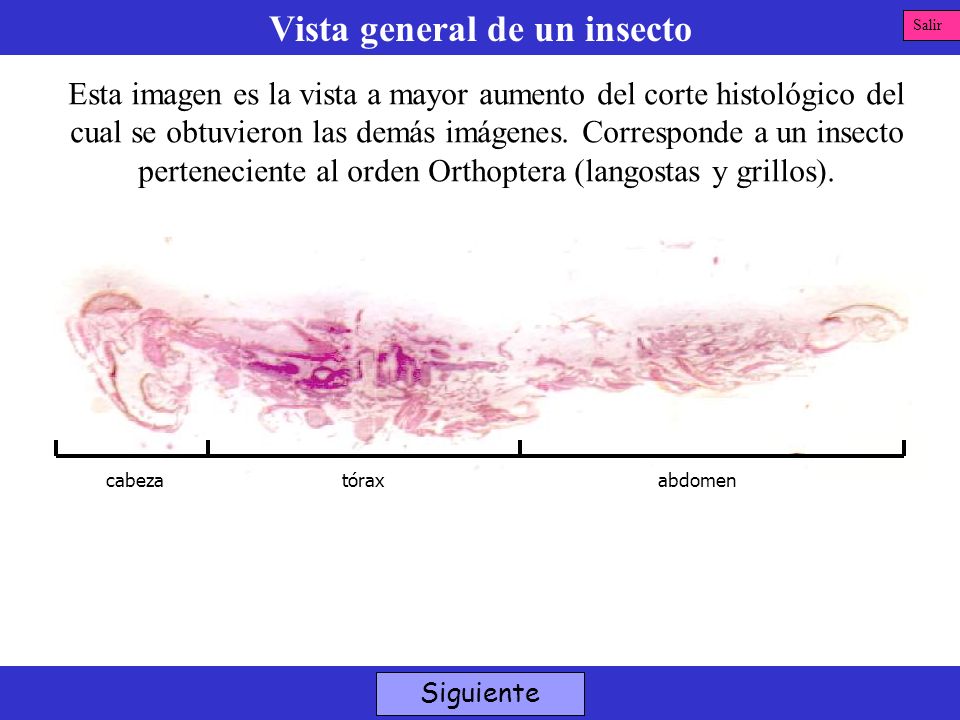 Vista general de un insecto
