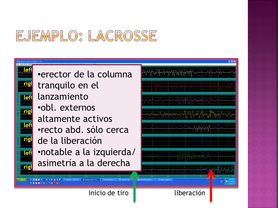 Ejemplo: lacrosse erector de la columna tranquilo en el lanzamiento