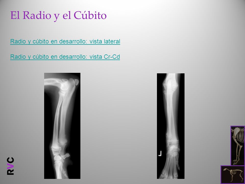 El Radio y el Cúbito Radio y cúbito en desarrollo: vista lateral