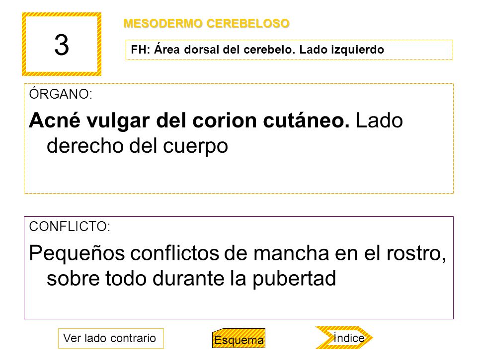 3 Acné vulgar del corion cutáneo. Lado derecho del cuerpo