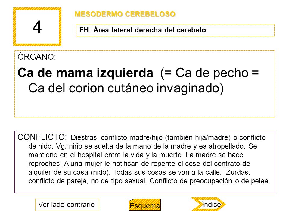 4 MESODERMO CEREBELOSO. FH: Área lateral derecha del cerebelo. ÓRGANO: Ca de mama izquierda (= Ca de pecho = Ca del corion cutáneo invaginado)