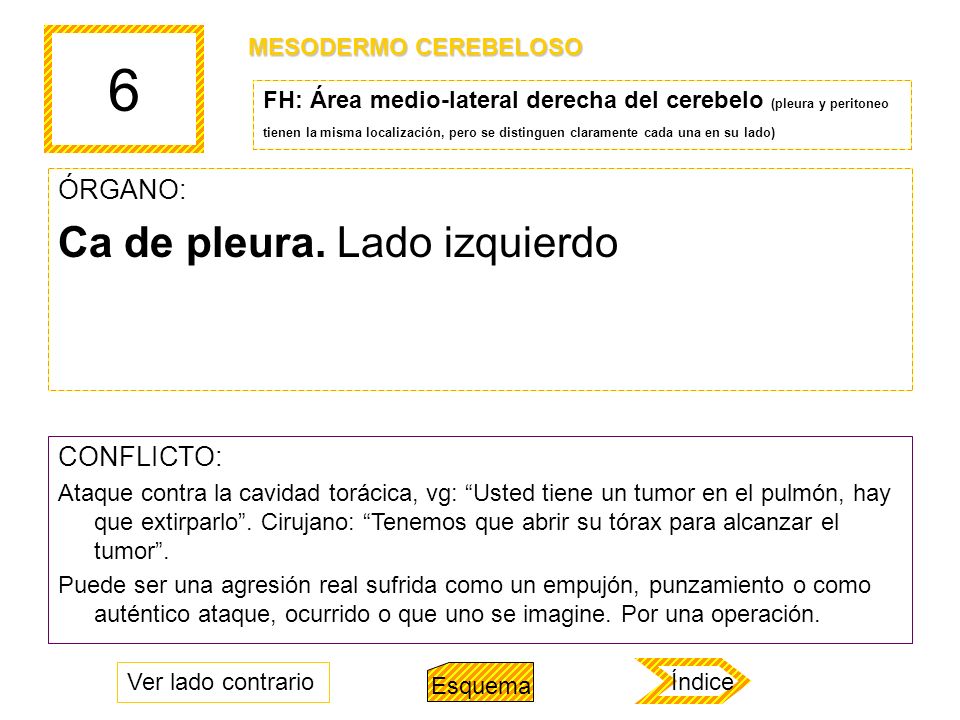 6 Ca de pleura. Lado izquierdo ÓRGANO: CONFLICTO: MESODERMO CEREBELOSO