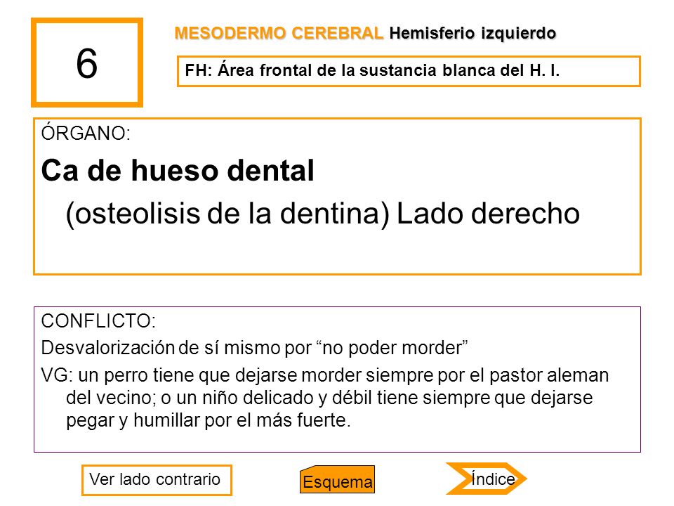 6 Ca de hueso dental (osteolisis de la dentina) Lado derecho ÓRGANO: