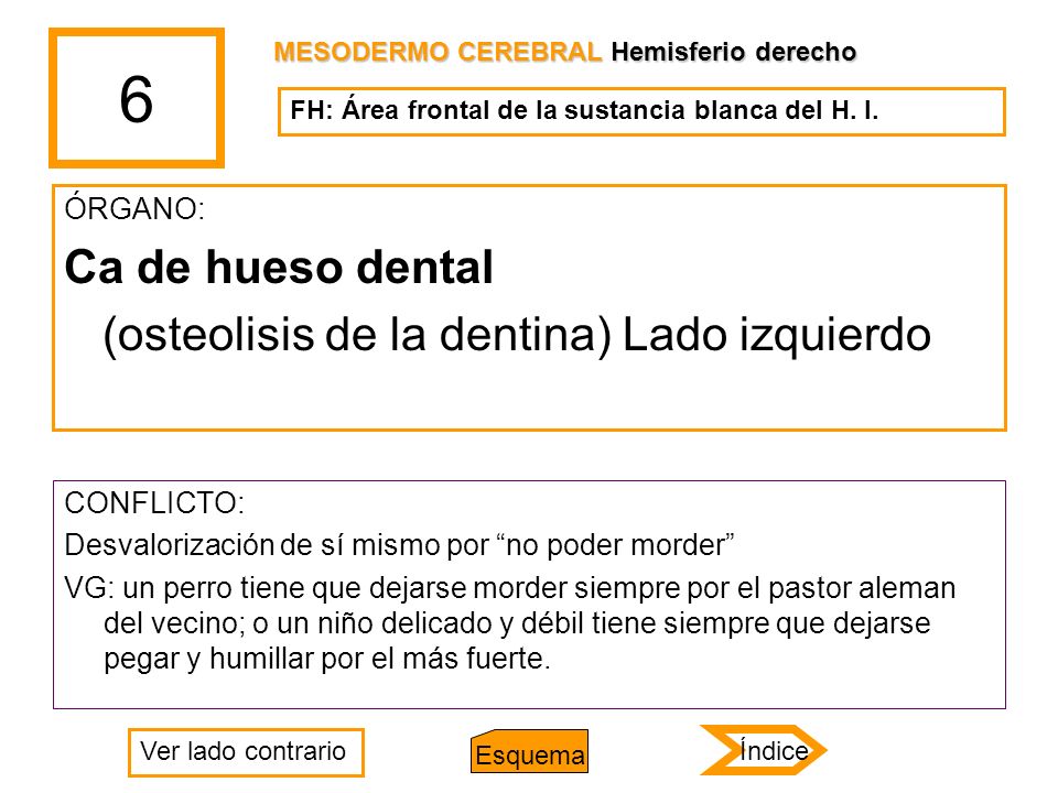 6 Ca de hueso dental (osteolisis de la dentina) Lado izquierdo ÓRGANO: