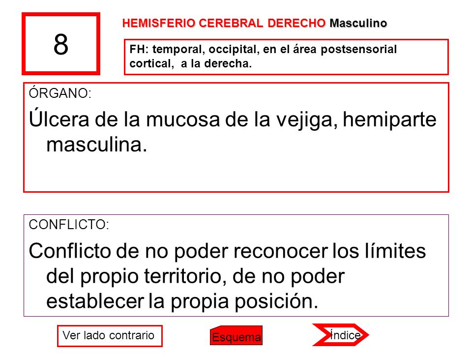 8 Úlcera de la mucosa de la vejiga, hemiparte masculina.