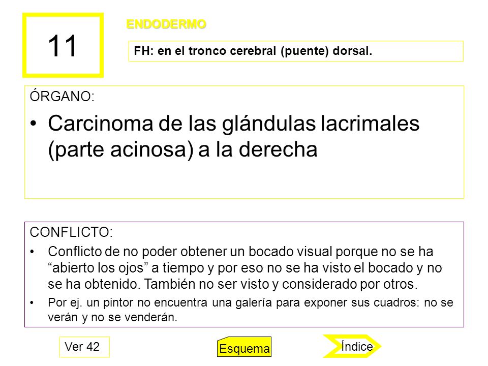 11 Carcinoma de las glándulas lacrimales (parte acinosa) a la derecha