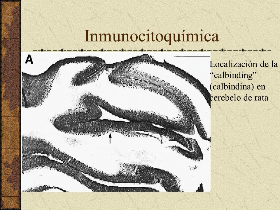 Inmunocitoquímica Localización de la calbinding (calbindina) en cerebelo de rata