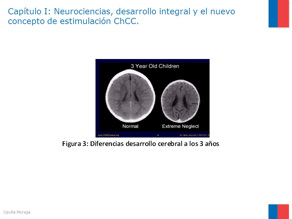 Capítulo I: Neurociencias, desarrollo integral y el nuevo concepto de estimulación ChCC.