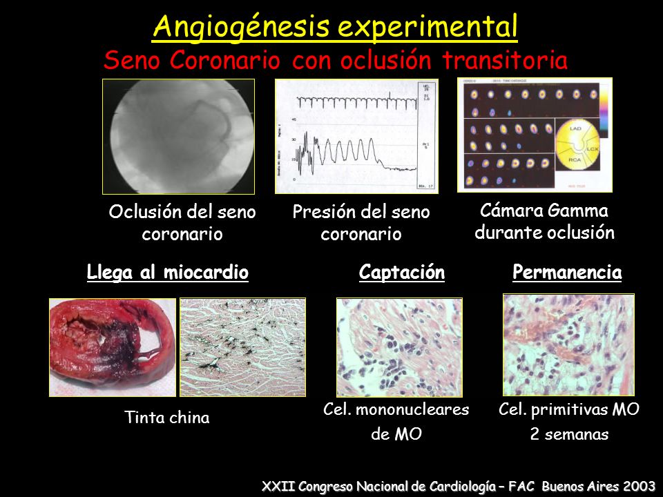 Angiogénesis experimental Seno Coronario con oclusión transitoria