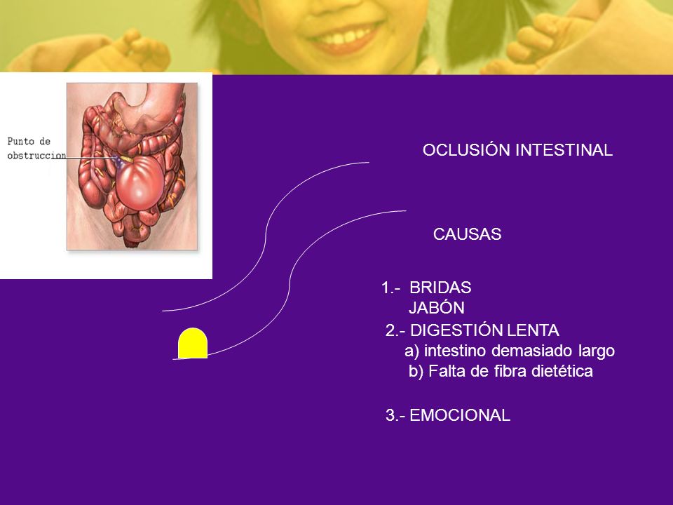 OCLUSIÓN INTESTINAL CAUSAS. 1.- BRIDAS. JABÓN. 2.- DIGESTIÓN LENTA. a) intestino demasiado largo.