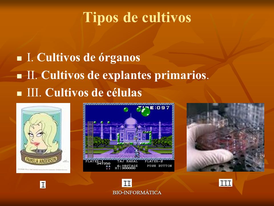 Tipos de cultivos I. Cultivos de órganos