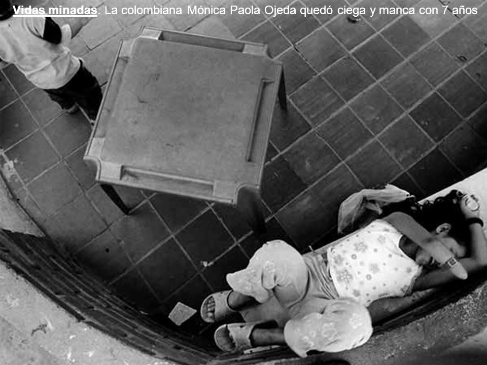 Vidas minadas. La colombiana Mónica Paola Ojeda quedó ciega y manca con 7 años