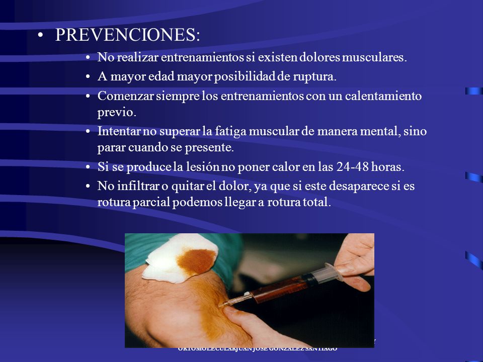 PREVENCIONES: No realizar entrenamientos si existen dolores musculares. A mayor edad mayor posibilidad de ruptura.