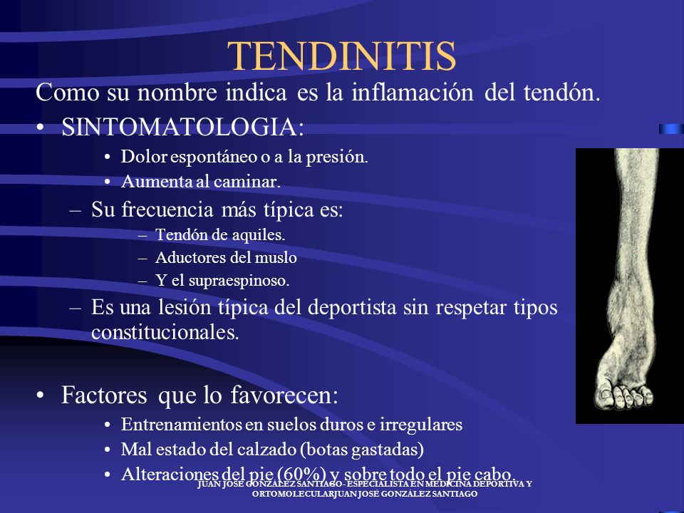 TENDINITIS Como su nombre indica es la inflamación del tendón.