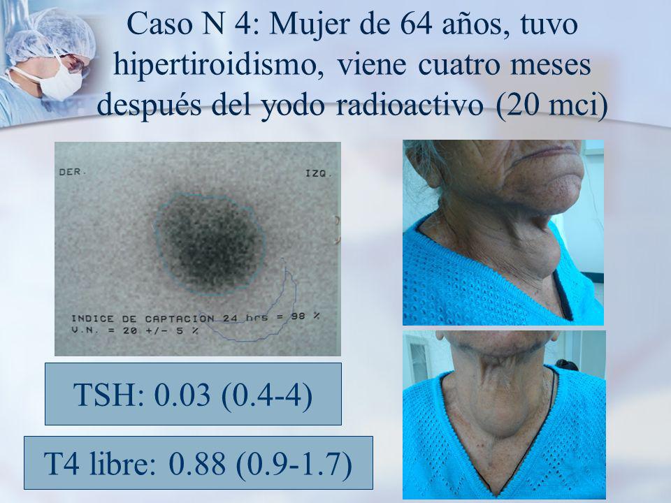 Caso N 4: Mujer de 64 años, tuvo hipertiroidismo, viene cuatro meses después del yodo radioactivo (20 mci)