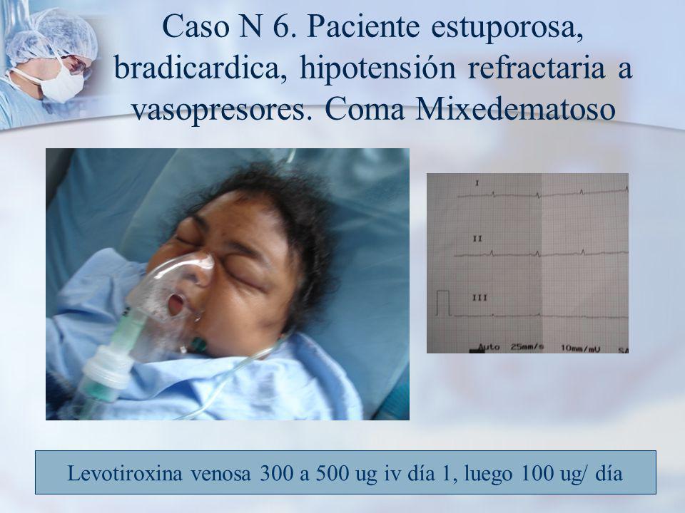 Levotiroxina venosa 300 a 500 ug iv día 1, luego 100 ug/ día