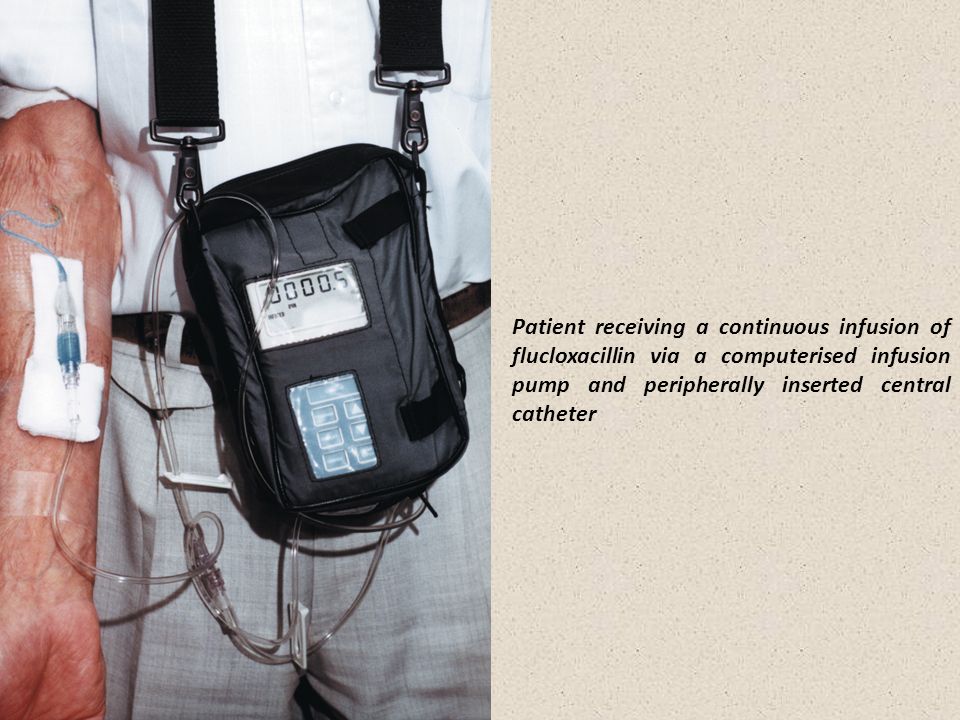 Patient receiving a continuous infusion of flucloxacillin via a computerised infusion pump and peripherally inserted central catheter