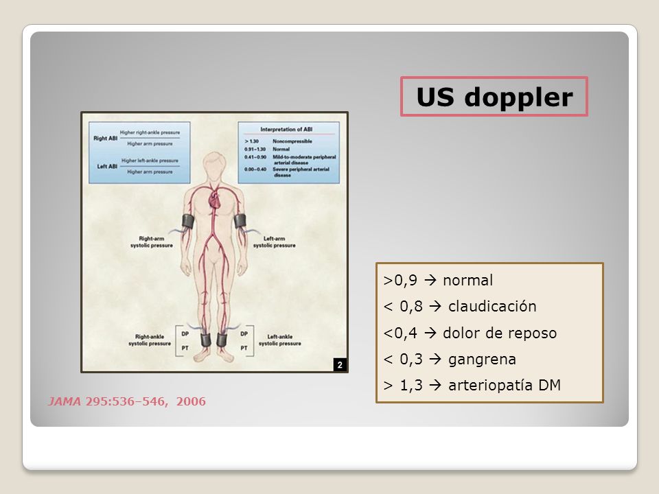 US doppler >0,9  normal < 0,8  claudicación