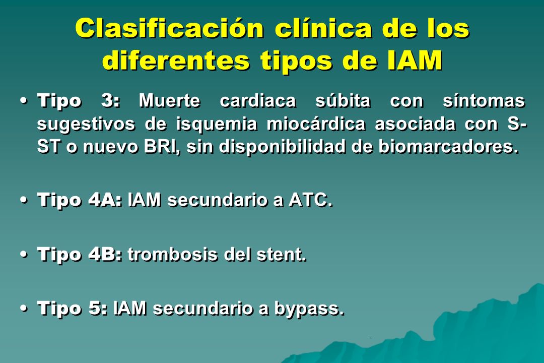 Clasificación clínica de los diferentes tipos de IAM